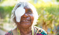 Close the gap in eye health for Indigenous Australians in Australia, Run by: The Fred Hollows Foundation 
