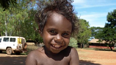 Indigenous childhood anaemia, Northern Territory