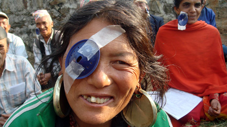 Outreach Microsurgical Eye Camp, Dhading