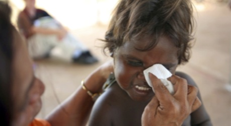 Restoring sight to Indigenous Australians, NT